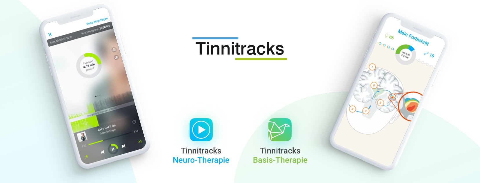 Acouphènes Tinnitracks